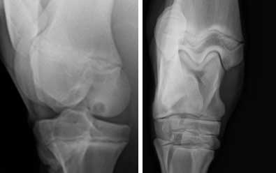 xray